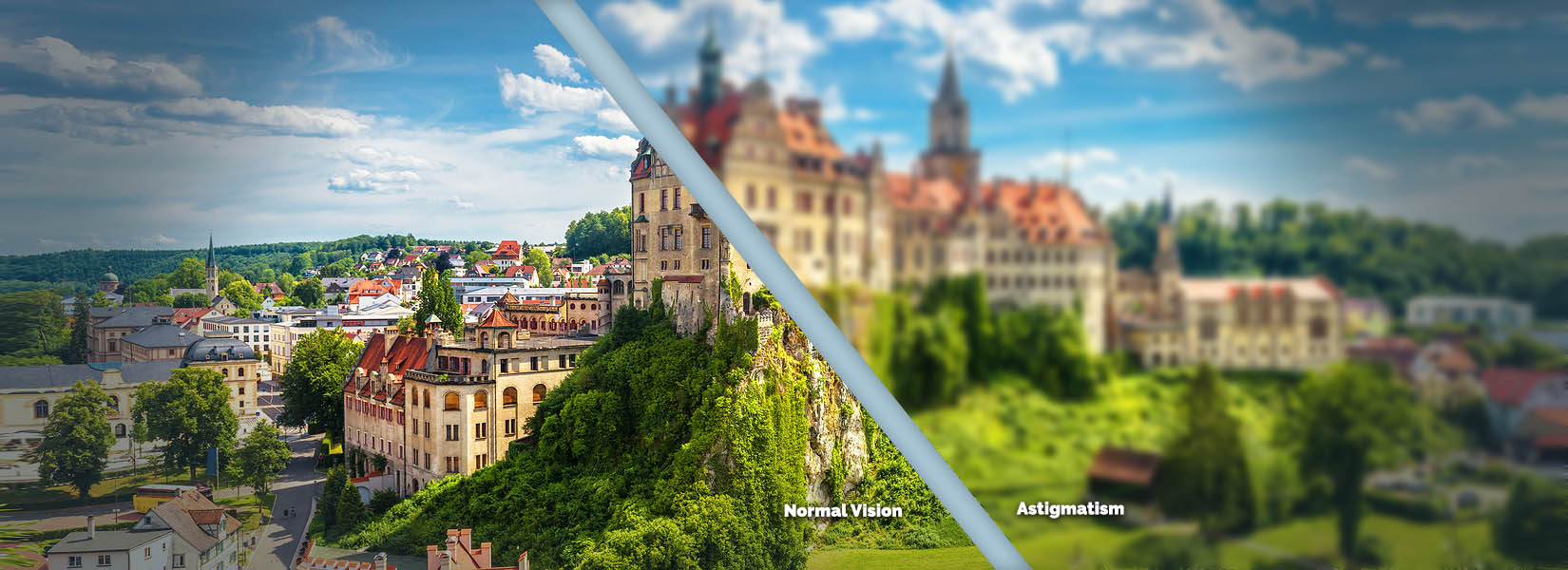 Astigmatism Treatment in Klein Crossing