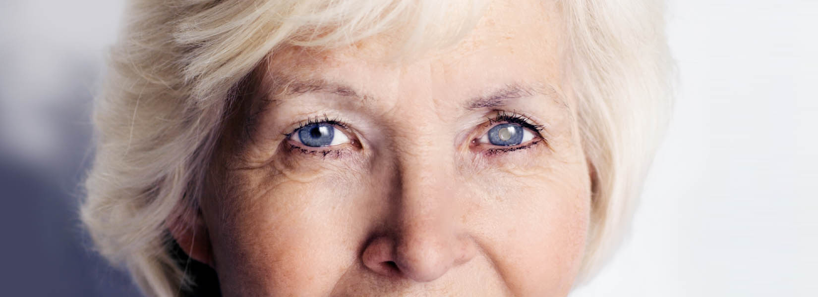 Cataract Surgery in Klein Crossing