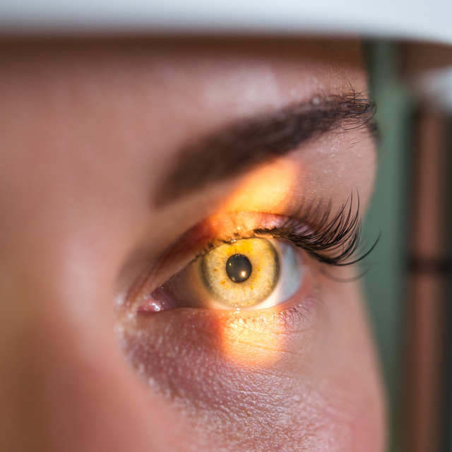 Vision Therapy in Klein Crossing